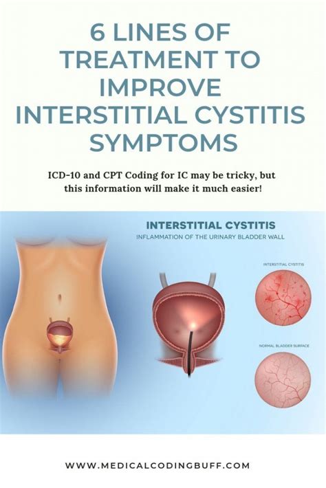 Interstitial Cystitis Symptoms And Causes Artofit