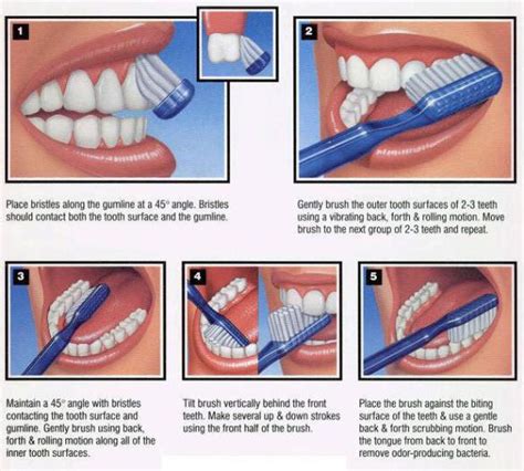 Tooth Brushing So Dental Chatswood