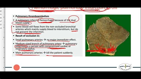 Pathloogy Hemodynamics Lab Youtube