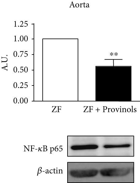 Provinols Modulated The Expression Of Cox Isoforms And Nf κb In Vessels