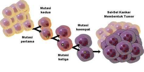 Kanker Keturunan: Apakah Kanker Dapat Diturunkan ke Anak?