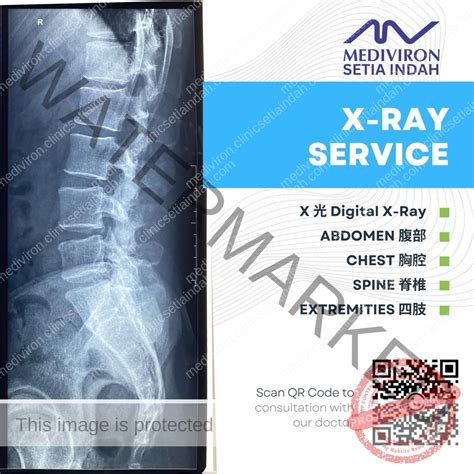 Klinik X Ray Johor Bahru Mediviron Setia Indah Clinic