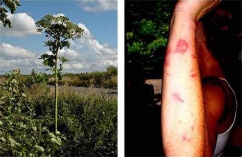 Dangers Of Giant Hogweed Heracleum Mantegazzianum Dangerous Species