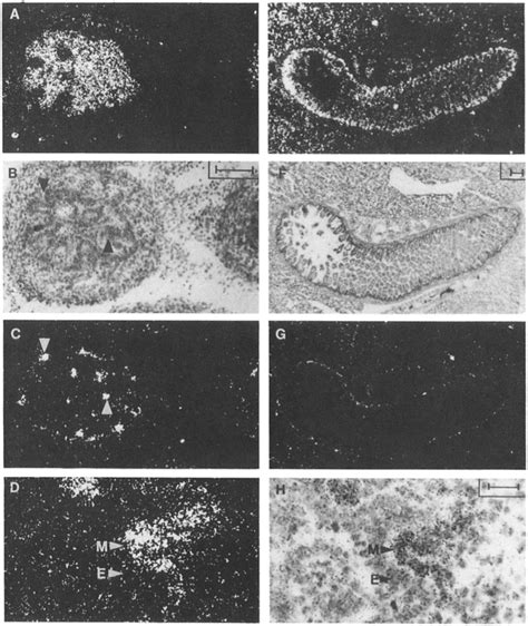 In Situ Hybridization Analysis Of Sf Hgf And C Met Expression In The