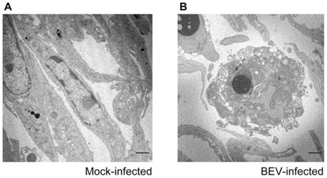 E Derm Cells Were Mock Infected A Or Infected With BEV 5 Pfu Cell