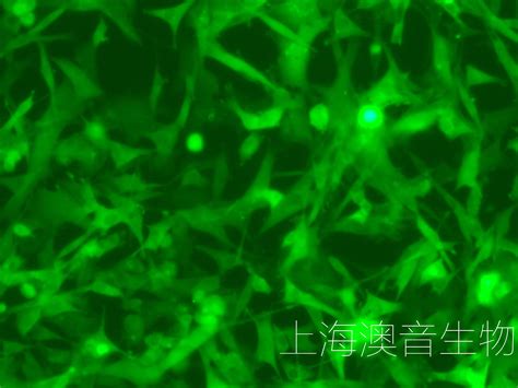 U 87mg Luc Gfp Puro双标记的人脑星形胶质母细胞瘤 企业官网