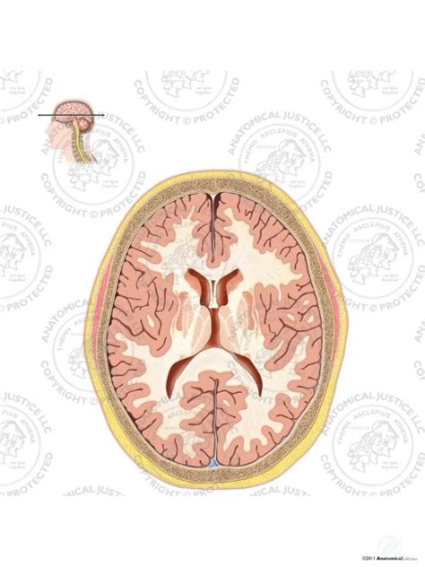 Cross Section Of The Brain Ventricular Level No Text