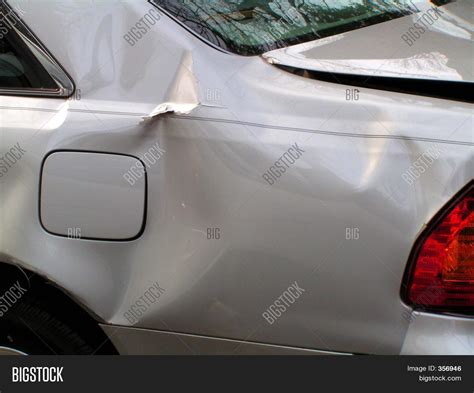 Body Damage Car Accident Image & Photo | Bigstock