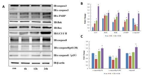 Autophagy Inhibitor Chloroquine Induces Apoptosis Of Cholangiocarcinoma