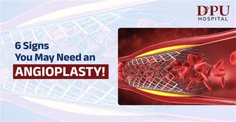 6 Signs You May Need An Angioplasty Dpu Hospital