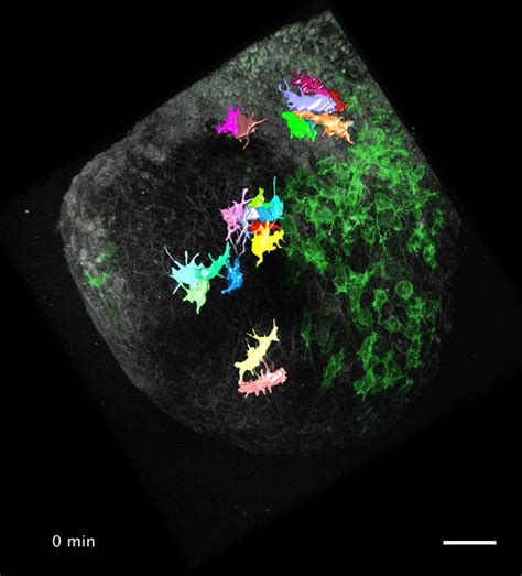 Figures And Data In Distinct Mesoderm Migration Phenotypes In Extra