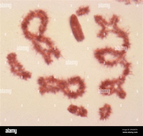 Crossing Over During Meiosis Light Micrograph Stock Photo Alamy