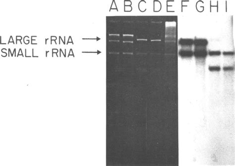 Denaturing Gel Electrophoresis Of Hybrids Isolated After Si Digestion Download Scientific