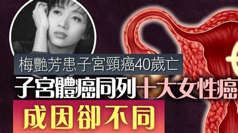 【梅艷芳逝世18周年】患子宮頸癌40歲亡 子宮體癌同列十大女性癌症 成因卻不同 活好的 So Fit So Good Line Today