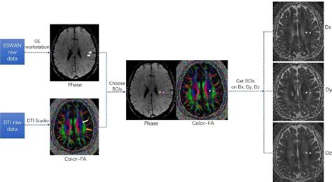 Figure 1 From Glymphatic Function Plays A Protective Role In Ageing