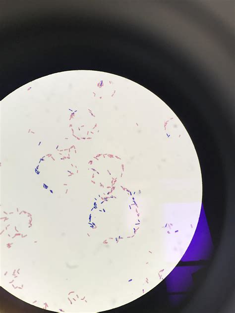 This bacillus made a figure “88” in a gram stain that I made. : r ...