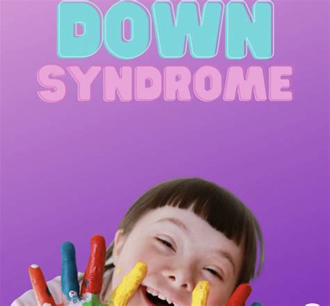 How is Down Syndrome Inherited? - Goally