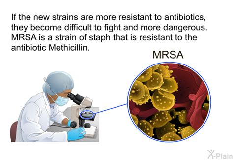 PatEdu.com : Preventing MRSA Infections - Community