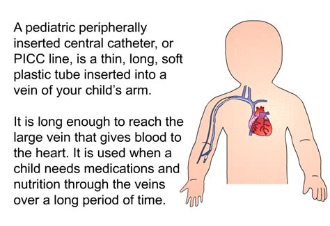 Peripherally Inserted Central Catheter Picc Line