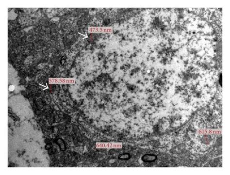 Transmission Electron Micrographs Of Sn Showing Ultrastructural Changes