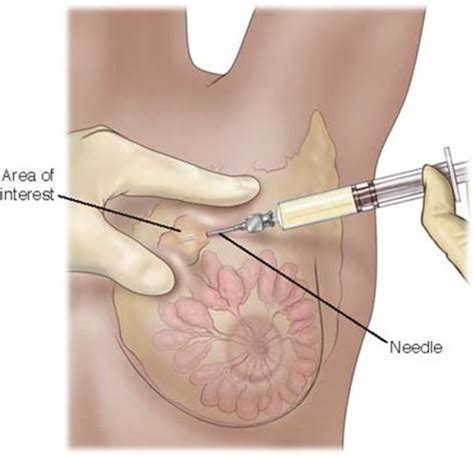 Chest Neck Cancer Chest Trauma Shock Hemodynamic Monitoring