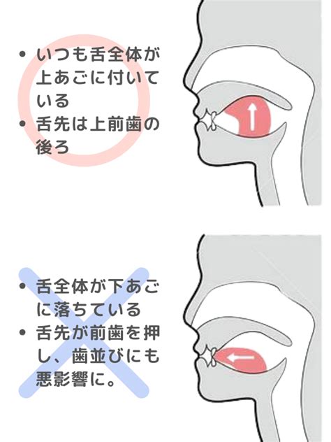 だからあなたは聞き返される！滑舌が悪い原因と対策4選 声となり空間