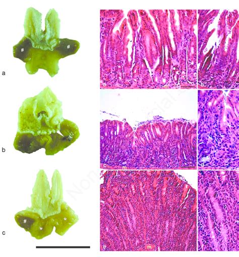 Antral Mucosa Of Mongolian Gerbils Infected With Helicobacter Pylori