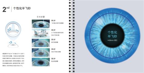 视力矫正，近视手术全飞秒和半飞秒哪个更好？视百年眼科