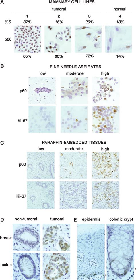 Immunocytochemical And Immunohistochemical Detection Of Chromatin