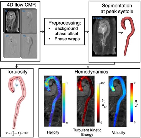 Frontiers Helical Flow In Tortuous Aortas And Its Relationship To