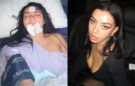 Charli XCX preocupa fãs ao aparecer em cama de hospital