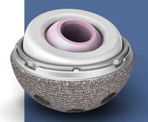 Stryker Mdm X Modular Dual Mobility Acetabular System Catalog