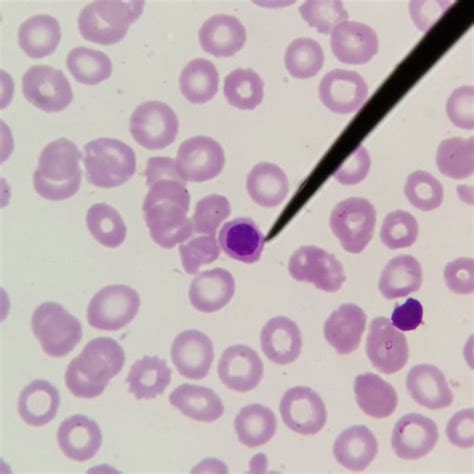 RBC WBC Morphology Flashcards Quizlet