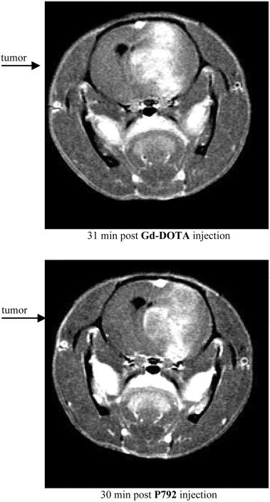 Comparison Of The Tumoral Biodistribution Of P A Rapid Clearance