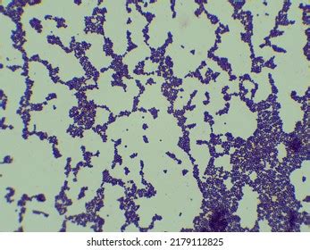 Gram Staining Staphylococcus Aureus Under Microscopes Stock Photo