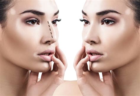 Miami Rhinoplasty Miami Rhinoplasty Plastic Surgery Facts Dr