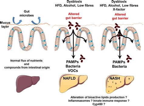 Gut microbiome and liver diseases | Gut