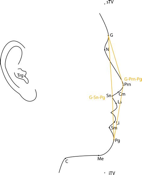 Angular Measurements G Sn Pg Angle Of Facial Convexity G Prn Pg Download Scientific Diagram