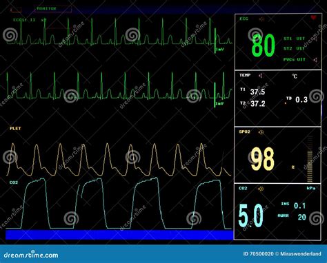 Electrocardiogram Screen Monitor Stock Photo Image Of Heartbeat