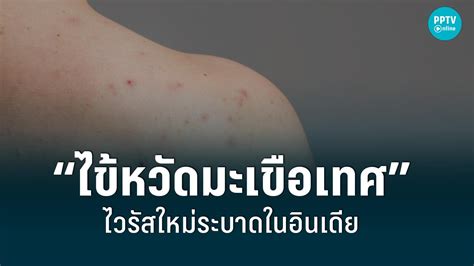 ไวรัสใหม่ ‘ไข้หวัดมะเขือเทศ’ กำลังระบาดในอินเดีย ลามแล้วใน 4 รัฐ พบผู้ติดเชื้อแล้วอย่างน้อย 80 คน