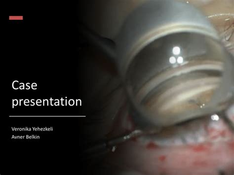 Uveitic glaucoma and GATT