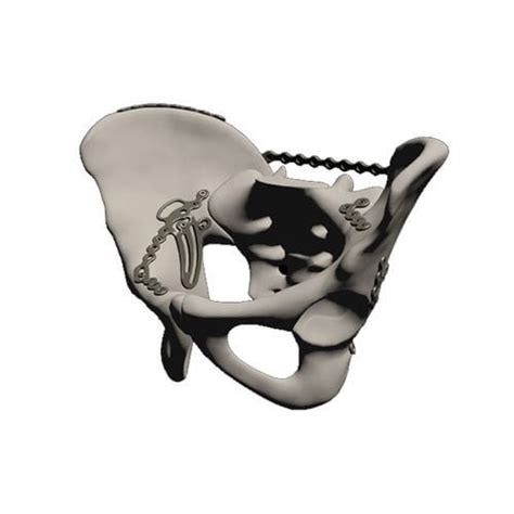 Acetabulum Compression Plate Prsphx I T S Pelvis Locking