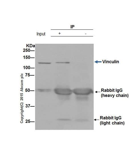 Recombinant Anti-Vinculin antibody [EPR8185] KO Tested (ab129002) | Abcam