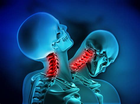 Shaw Law | Neck and Disc Injuries