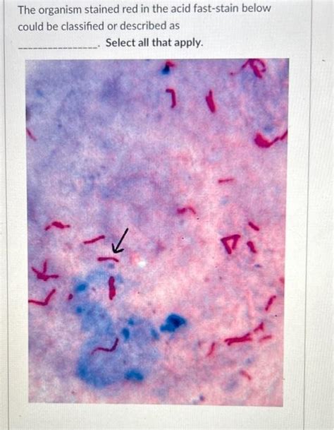 Mycobacterium Leprae Acid Fast