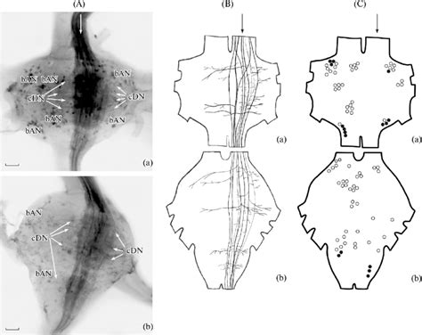 Total preparations (A), diagrams of collateral branching in descending... | Download Scientific ...