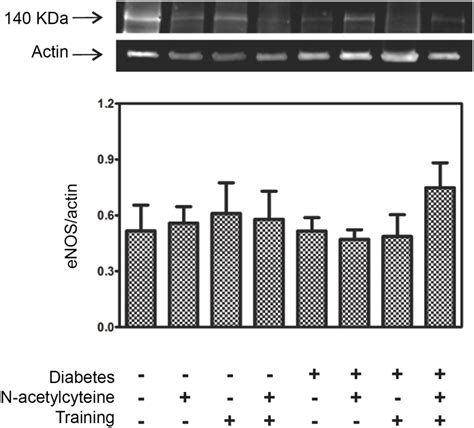 Western Blot Analysis Of Enos In Samples Of Renal Cortex At The 8th Download Scientific Diagram