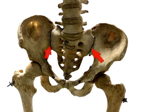 Diagnose Von Axialer Spondyloarthritis Joachim Sieper Im Interview