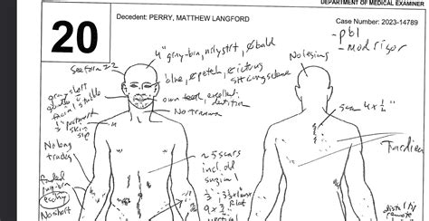 Informe Completo De La Autopsia De Matthew Perry Ver