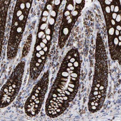 MRPL12 Polyclonal Antibody Invitrogen 100 μL Unconjugated Antibodies